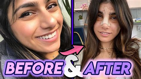 Mia Khalifa gets new nose job as she makes admission about。